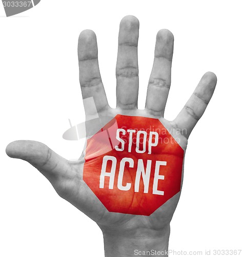 Image of Stop Acne Sign Painted, Open Hand Raised.