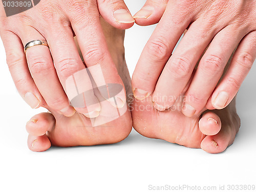 Image of Hands pulling toes on barefoot feet with shadow effect