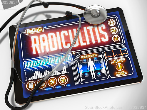 Image of Radiculitis on the Medical Tablet.