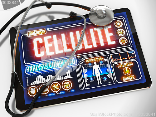 Image of Cellulite on the Display of Medical Tablet.