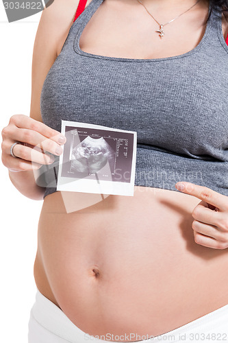 Image of Pregnant woman displaying a prenatal ultrasound