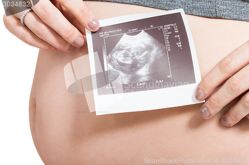 Image of Pregnant woman displaying a prenatal ultrasound