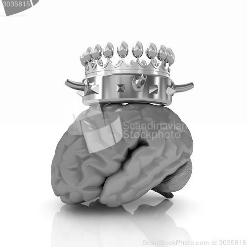 Image of Gold Crown on the brain