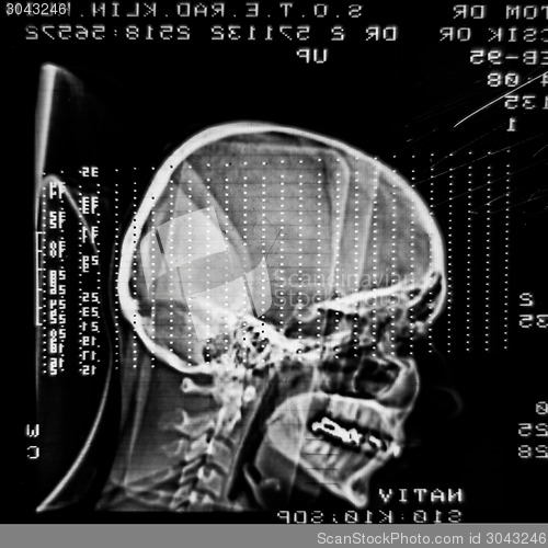 Image of Glowing and radiant MRI scan