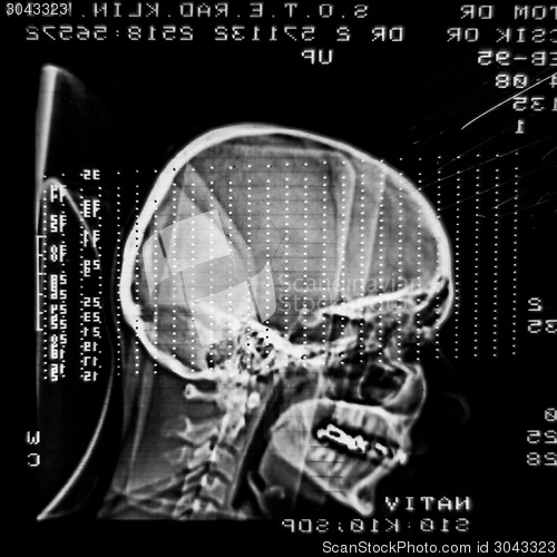 Image of Glowing and radiant MRI scan