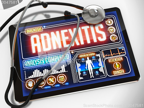 Image of Adnexitis on the Display of Medical Tablet.