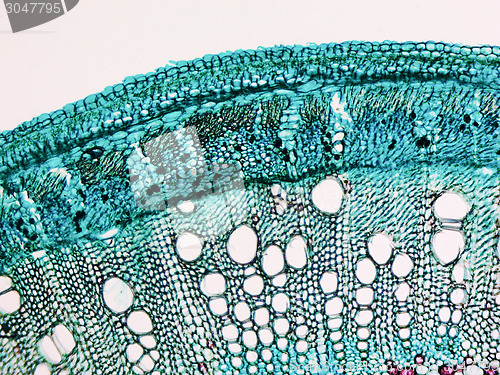 Image of Cotton stem micrograph