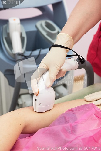 Image of photo epilation