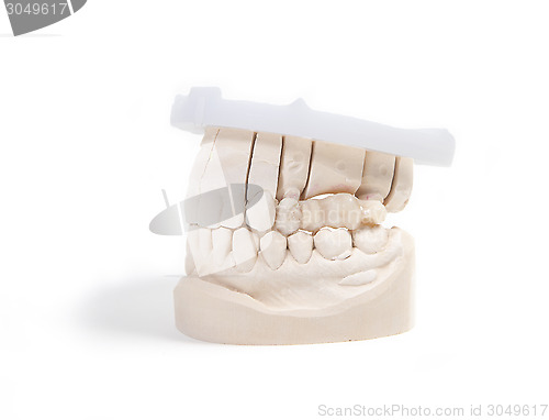 Image of teeth denture