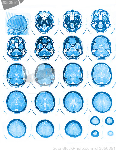 Image of CT and MRI of the skull