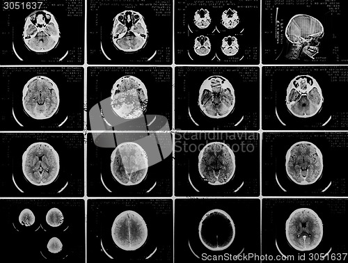 Image of Glowing and radiant MRI scan