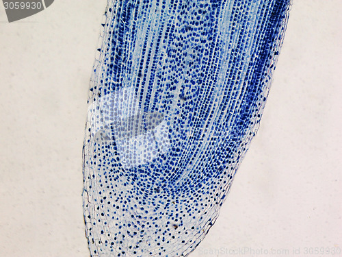 Image of Cells mitosis micrograph