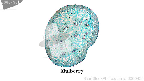 Image of Mulberry micrograph