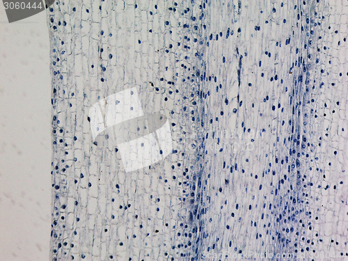 Image of Corn root tip micrograph