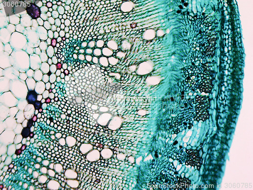 Image of Cotton stem micrograph