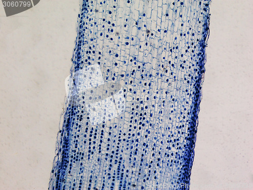 Image of Cells mitosis micrograph