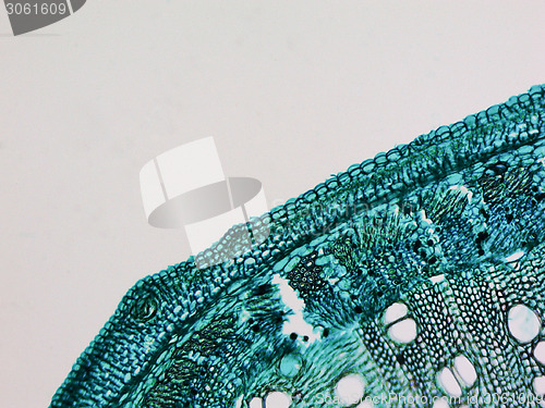 Image of Cotton stem micrograph