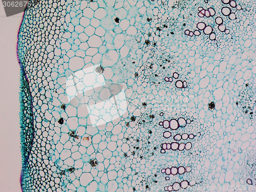 Image of Mulberry micrograph