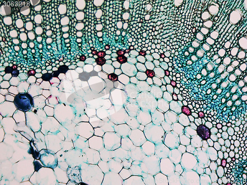 Image of Cotton stem micrograph