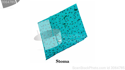 Image of Stoma micrograph