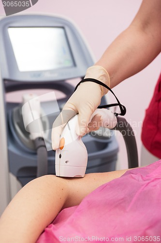 Image of photo epilation