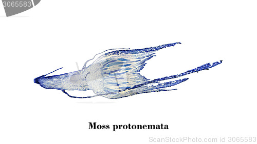 Image of Moss protonemata micrograph