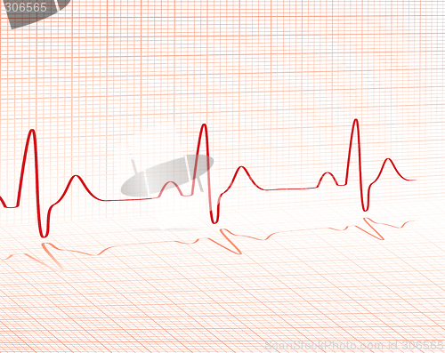 Image of heart beat red grid