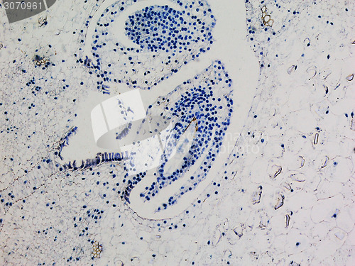 Image of Lily ovary micrograph