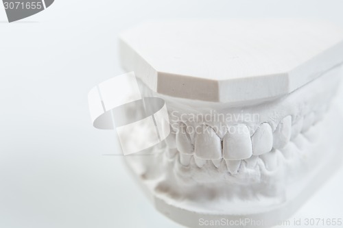 Image of Gypsum model of human jaw on a white background.