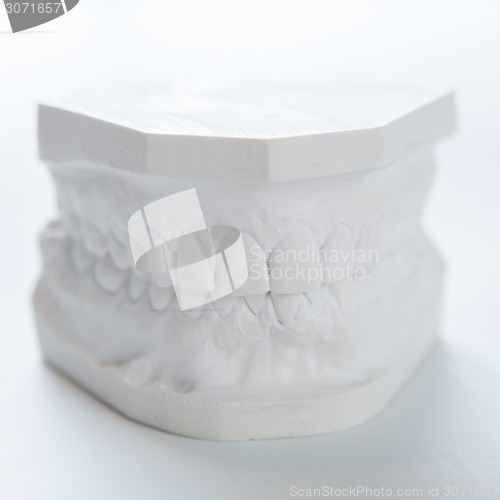 Image of Gypsum model of human jaw on a white background.