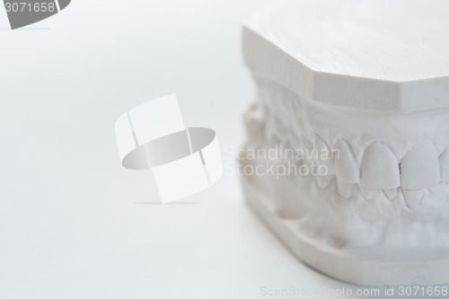 Image of Gypsum model of human jaw on a white background.