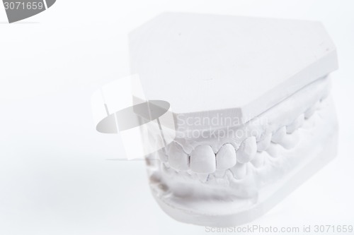 Image of Gypsum model of human jaw on a white background.