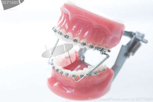 Image of Dental lower jaw bracket braces model on white