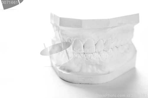 Image of Gypsum model of human jaw on a white background.