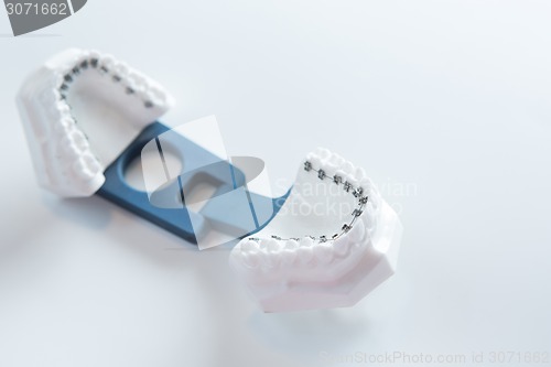 Image of Dental lower jaw bracket braces model on white