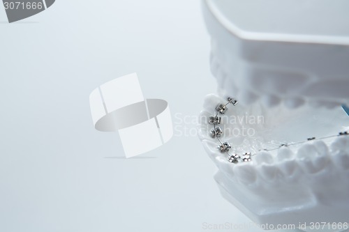 Image of Dental lower jaw bracket braces model on white