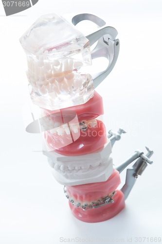 Image of Dental model