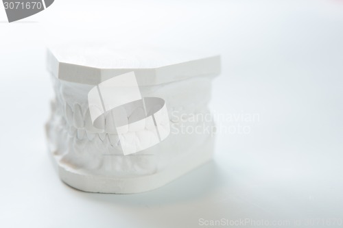 Image of Gypsum model of human jaw on a white background.