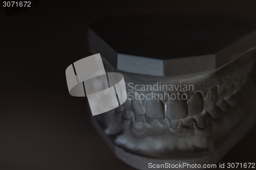 Image of Gypsum model of human jaw on a white background.