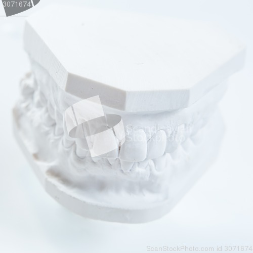 Image of Gypsum model of human jaw on a white background.