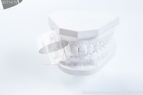 Image of Gypsum model of human jaw on a white background.