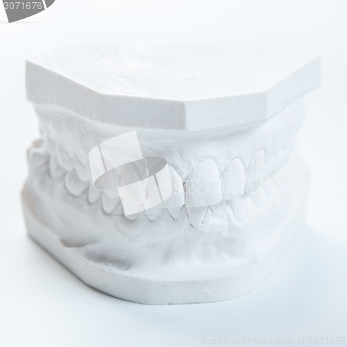 Image of Gypsum model of human jaw on a white background.