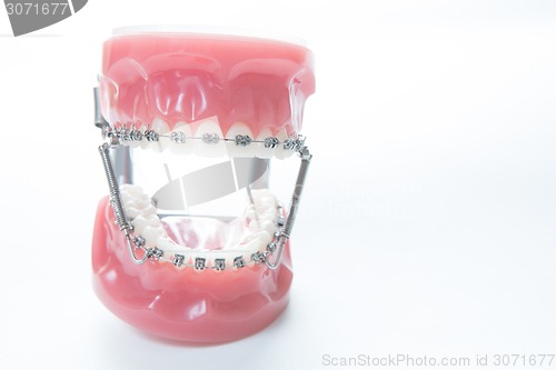 Image of Dental lower jaw bracket braces model on white