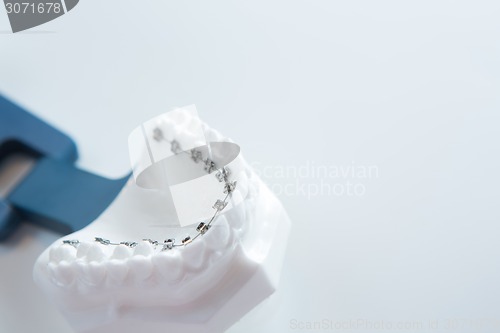 Image of Dental lower jaw bracket braces model on white