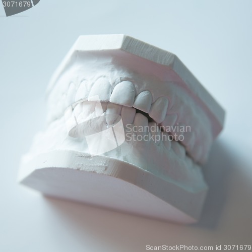 Image of Gypsum model of human jaw on a white background.