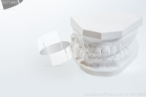 Image of Gypsum model of human jaw on a white background.