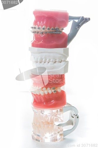 Image of Dental model