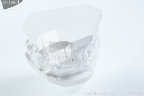 Image of Gypsum model of human jaw on a white background.