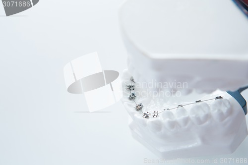 Image of Dental lower jaw bracket braces model on white