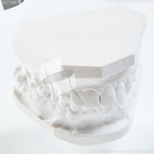 Image of Gypsum model of human jaw on a white background.